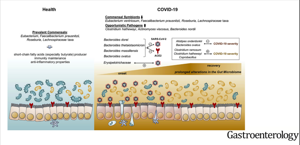 Gut Bacterial Alterations in COVID-19